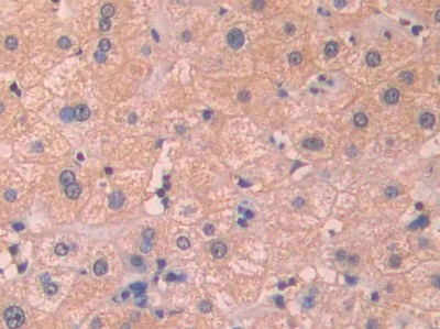 Polyclonal Antibody to Complement Factor B (CFB)