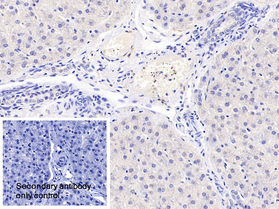 Polyclonal Antibody to Complement Factor B (CFB)