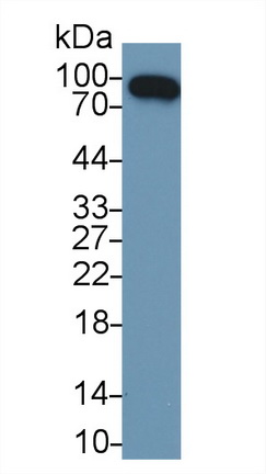 Polyclonal Antibody to Complement Factor B (CFB)