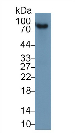 Polyclonal Antibody to Complement Factor B (CFB)