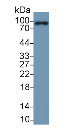 Polyclonal Antibody to Complement Factor B (CFB)