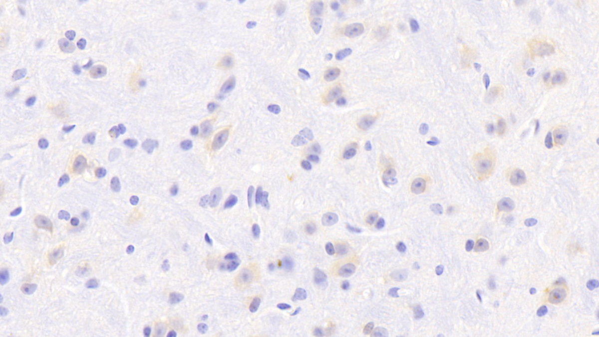 Polyclonal Antibody to Dihydropyrimidine Dehydrogenase (DPYD)