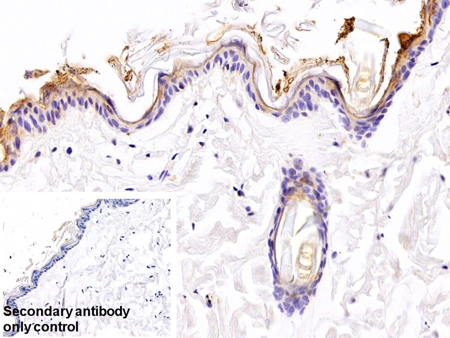 Polyclonal Antibody to S100 Calcium Binding Protein A3 (S100A3)