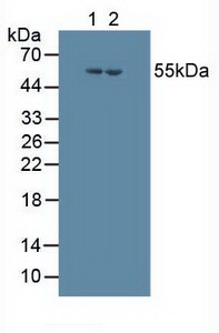 Polyclonal Antibody to Cytochrome P450 17A1 (CYP17A1)