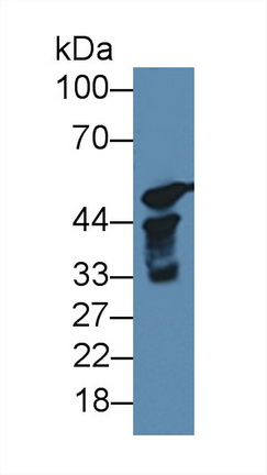 Polyclonal Antibody to Cytochrome P450 17A1 (CYP17A1)