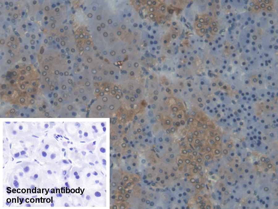 Polyclonal Antibody to Cytochrome P450 17A1 (CYP17A1)