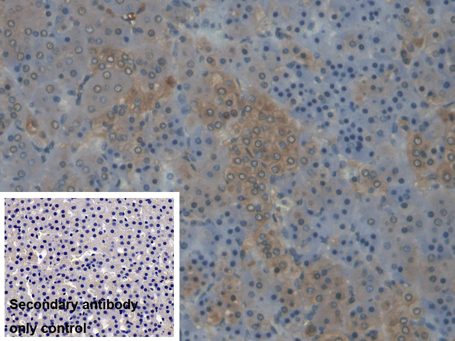 Polyclonal Antibody to Cytochrome P450 17A1 (CYP17A1)