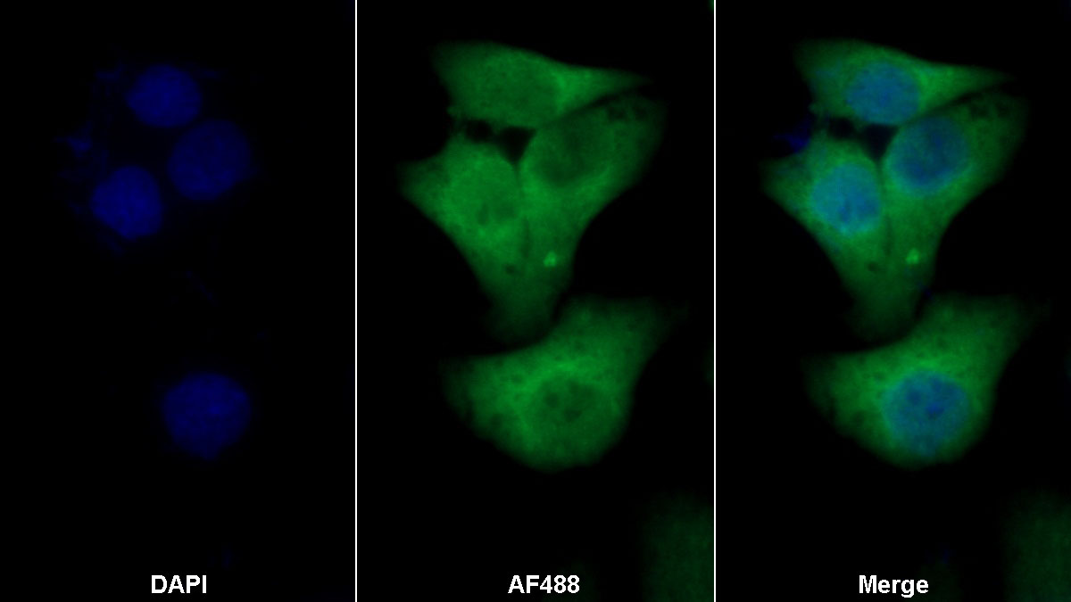 Polyclonal Antibody to S100 Calcium Binding Protein A4 (S100A4)