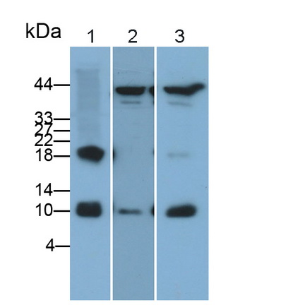 Polyclonal Antibody to S100 Calcium Binding Protein A4 (S100A4)