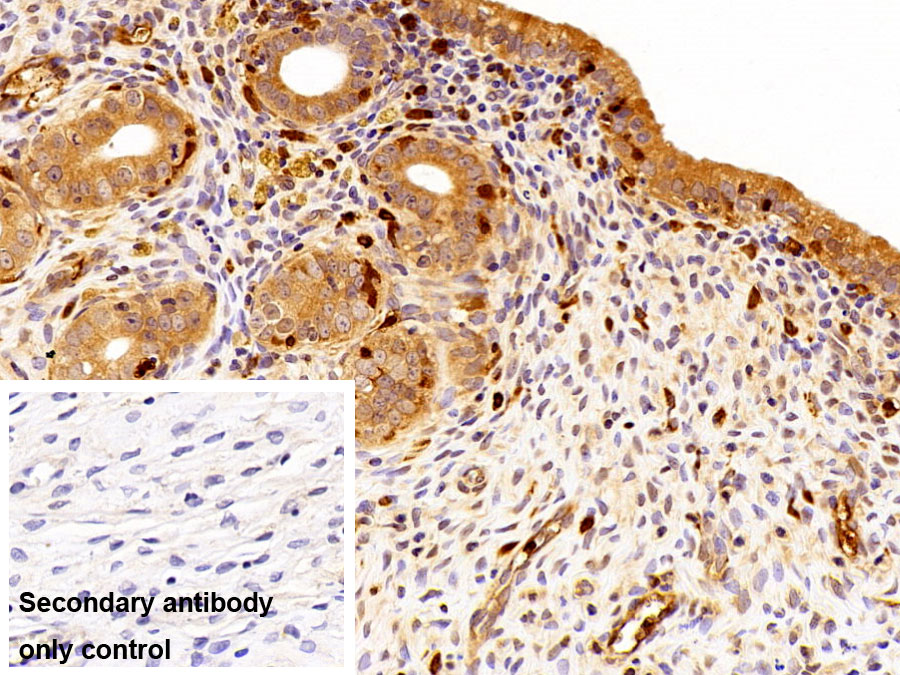 Polyclonal Antibody to S100 Calcium Binding Protein A4 (S100A4)