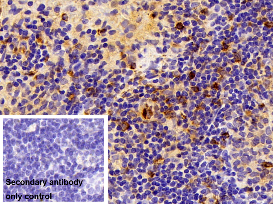 Polyclonal Antibody to S100 Calcium Binding Protein A4 (S100A4)