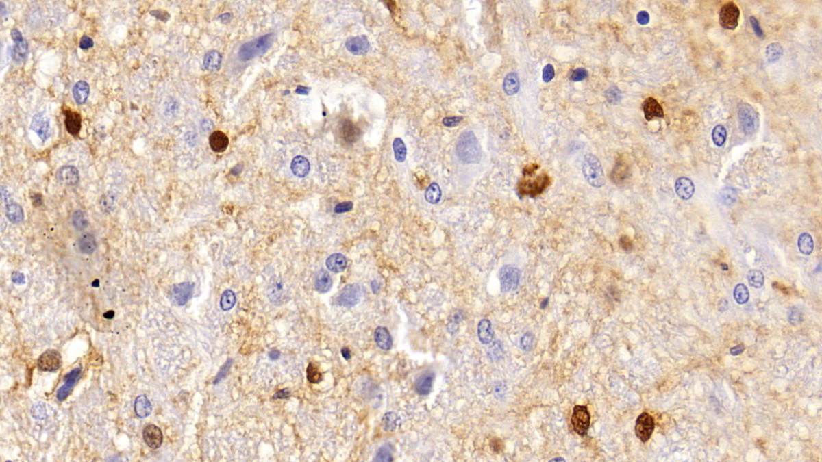 Polyclonal Antibody to S100 Calcium Binding Protein A5 (S100A5)