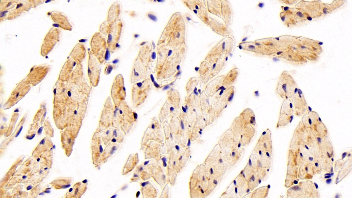 Polyclonal Antibody to Glucose Transporter 4 (GLUT4)