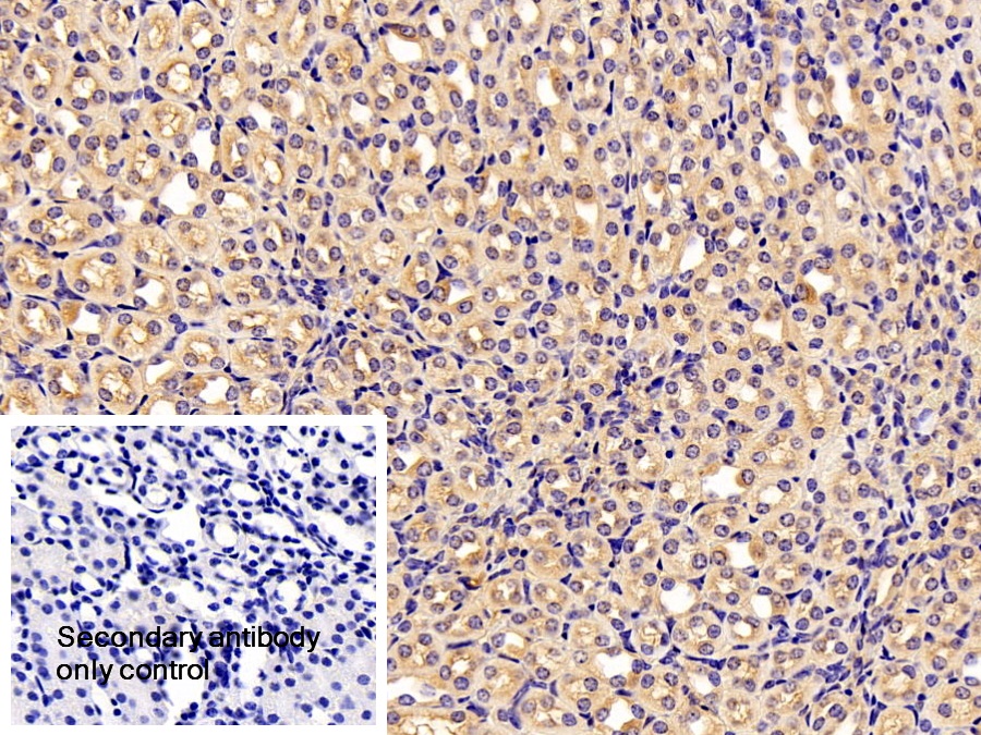 Polyclonal Antibody to Glucose Transporter 4 (GLUT4)