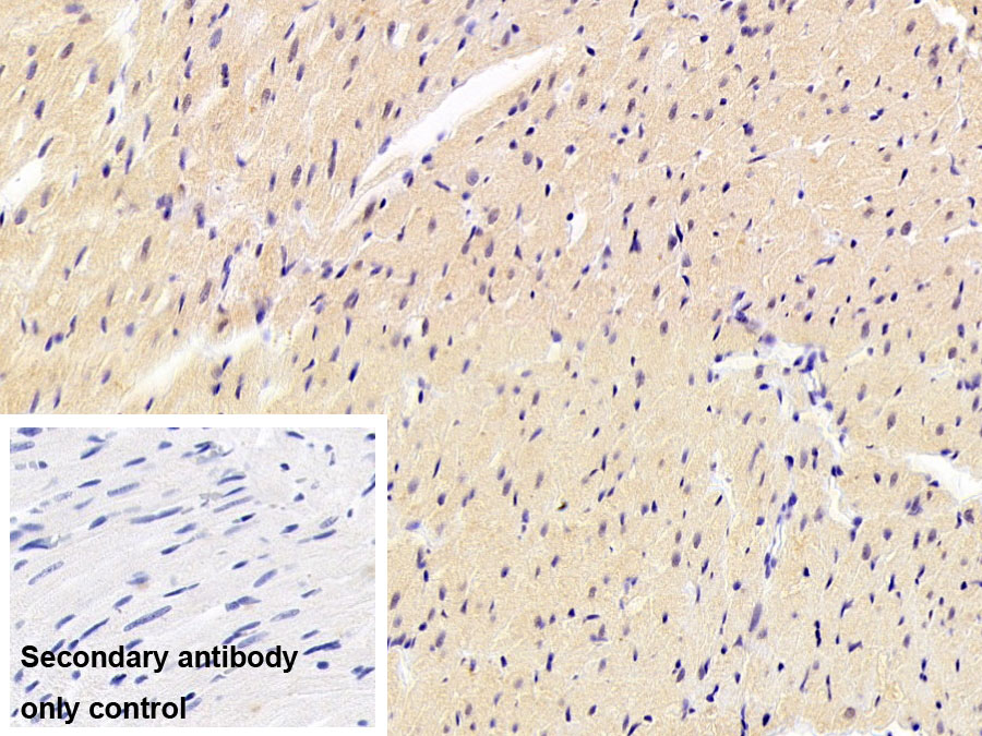 Polyclonal Antibody to Glucose Transporter 4 (GLUT4)