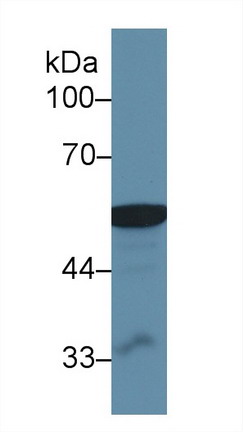 Polyclonal Antibody to Aldehyde Dehydrogenase, Mitochondrial (ALDH2)