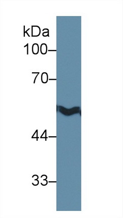 Polyclonal Antibody to Aldehyde Dehydrogenase, Mitochondrial (ALDH2)