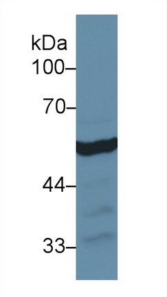 Polyclonal Antibody to Aldehyde Dehydrogenase, Mitochondrial (ALDH2)