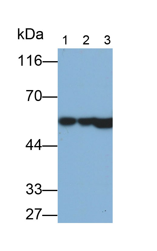 Polyclonal Antibody to Cytokeratin 8 (CK8)