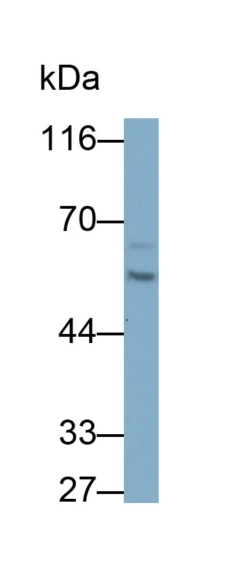 Polyclonal Antibody to Cytokeratin 8 (CK8)