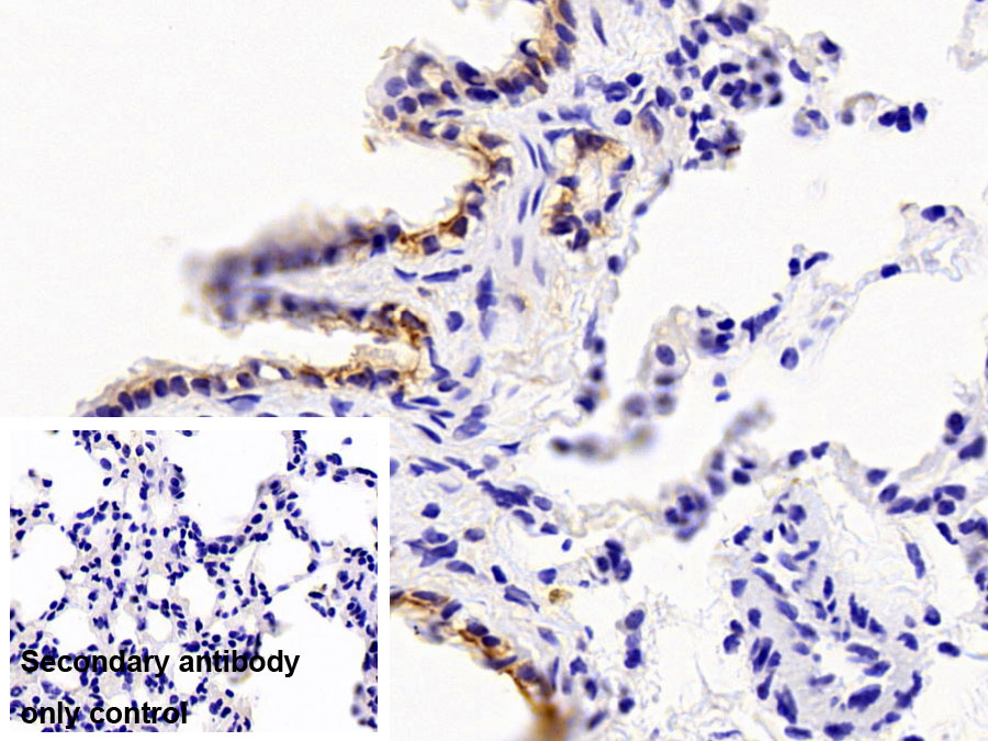 Polyclonal Antibody to Cytokeratin 8 (CK8)