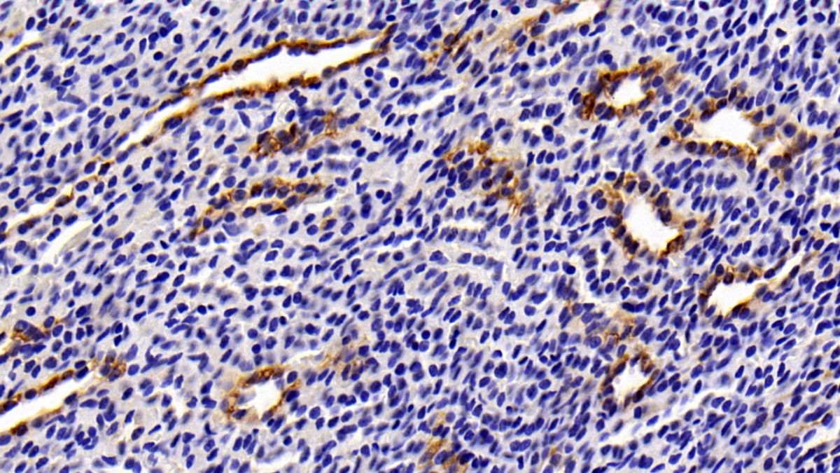 Polyclonal Antibody to Cytokeratin 8 (CK8)