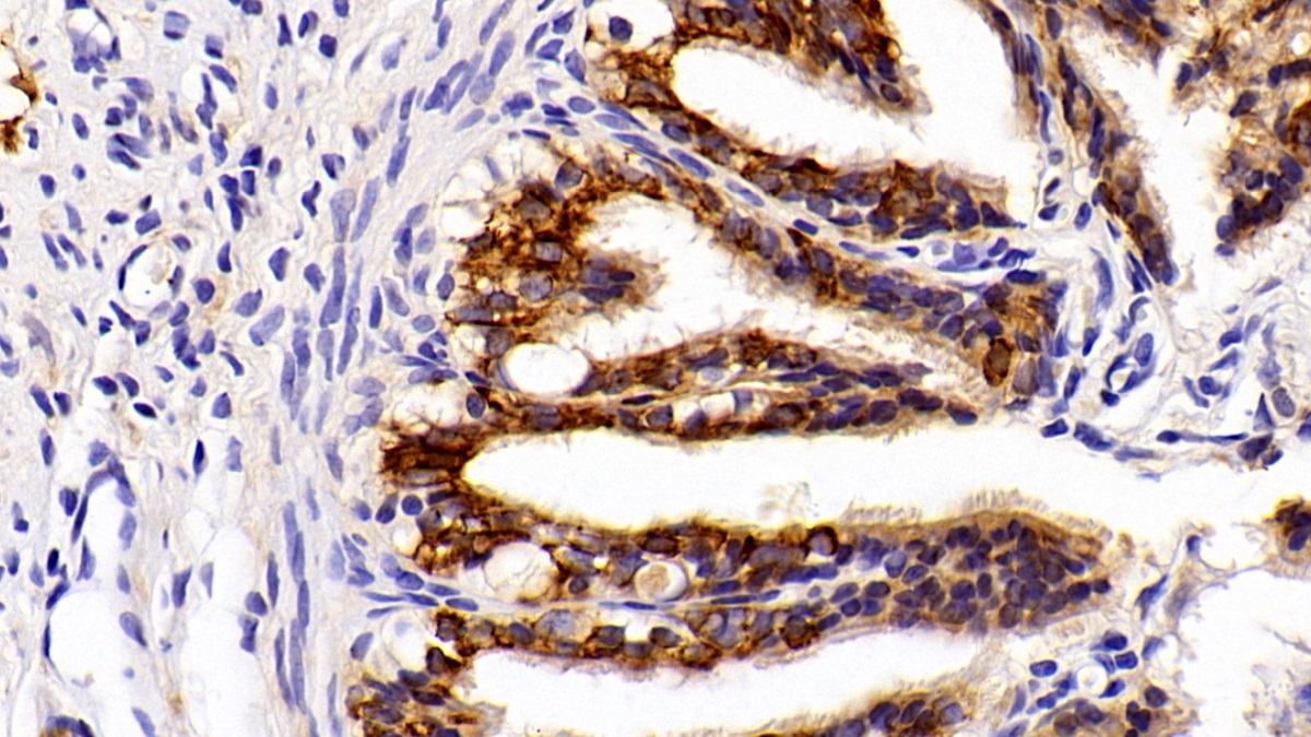 Polyclonal Antibody to Cytokeratin 8 (CK8)