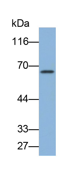 Polyclonal Antibody to Cytokeratin 8 (CK8)