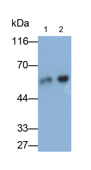 Polyclonal Antibody to Cytokeratin 8 (CK8)