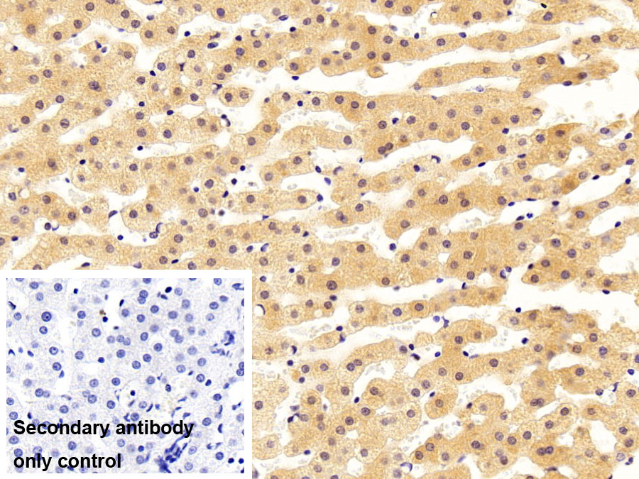 Polyclonal Antibody to O-6-Methylguanine DNA Methyltransferase (MGMT)