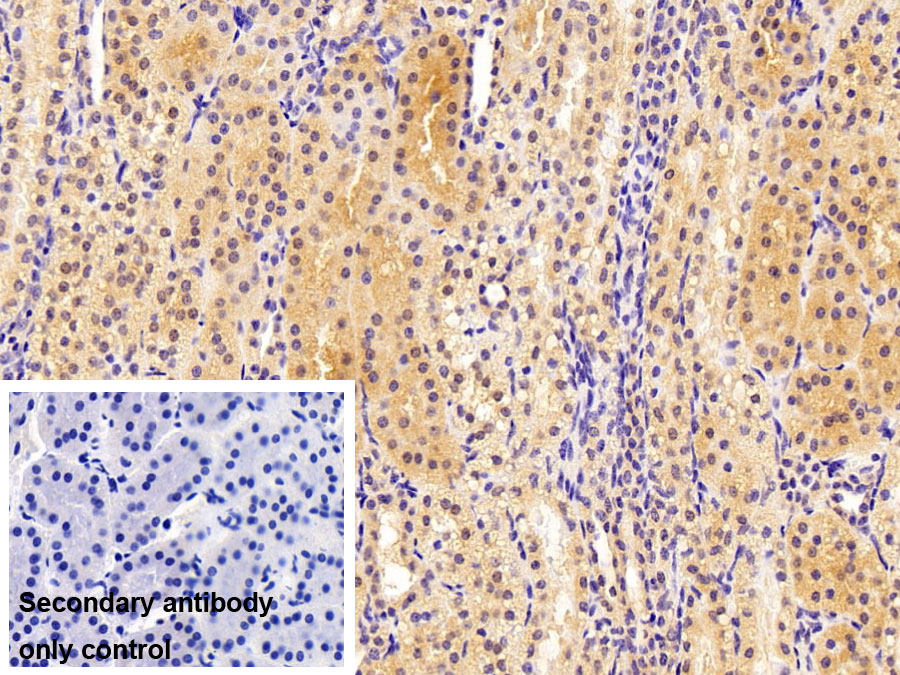 Polyclonal Antibody to O-6-Methylguanine DNA Methyltransferase (MGMT)