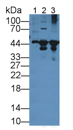 Polyclonal Antibody to Creatine Kinase B (CK-BB)