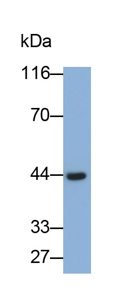 Polyclonal Antibody to Creatine Kinase B (CK-BB)