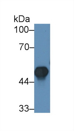 Polyclonal Antibody to Creatine Kinase B (CK-BB)