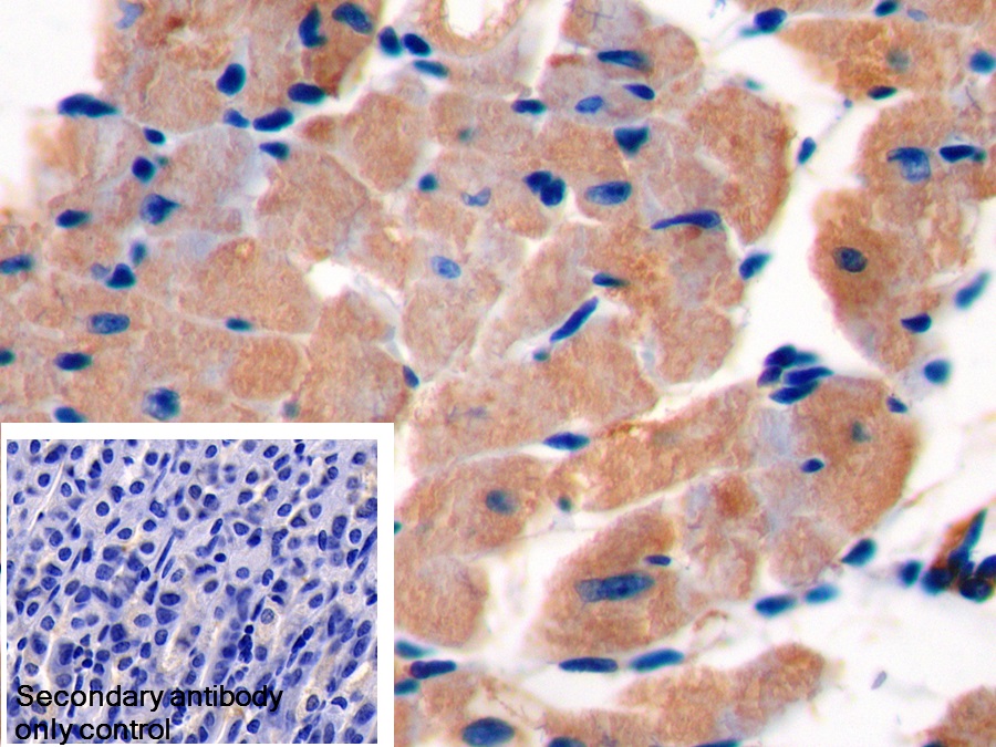 Polyclonal Antibody to Creatine Kinase B (CK-BB)