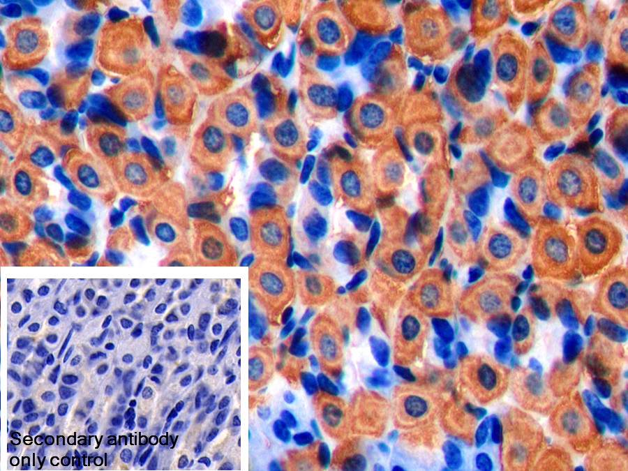 Polyclonal Antibody to Creatine Kinase B (CK-BB)