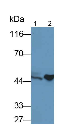 Polyclonal Antibody to Creatine Kinase B (CK-BB)