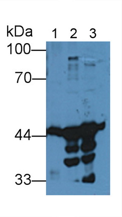 Polyclonal Antibody to Creatine Kinase B (CK-BB)