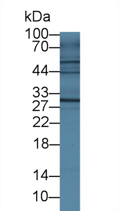 Polyclonal Antibody to Interleukin 4 Receptor (IL4R)