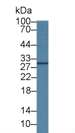 Polyclonal Antibody to Interleukin 4 Receptor (IL4R)