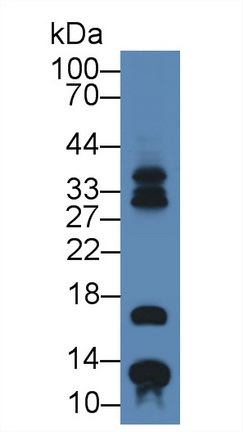 Polyclonal Antibody to S100 Calcium Binding Protein A7 (S100A7)