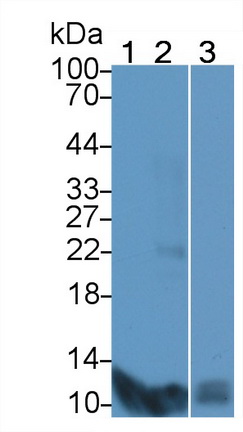 Polyclonal Antibody to S100 Calcium Binding Protein A7 (S100A7)