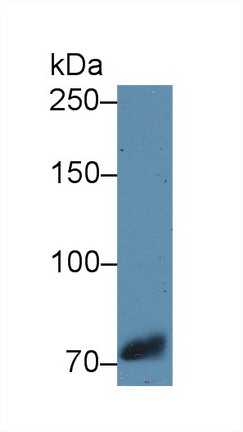 Polyclonal Antibody to Transferrin (TF)