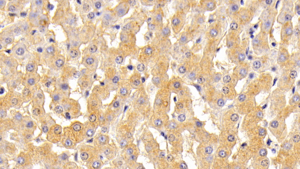 Polyclonal Antibody to Transferrin (TF)