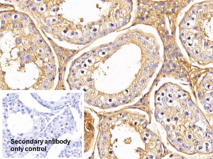 Polyclonal Antibody to Transferrin (TF)