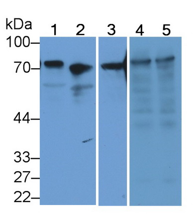 Polyclonal Antibody to Transferrin (TF)