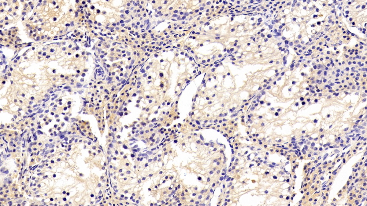 Polyclonal Antibody to Transferrin (TF)