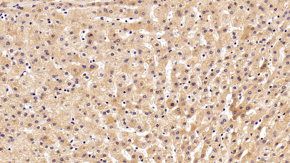 Polyclonal Antibody to Transferrin (TF)