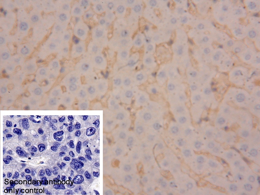 Polyclonal Antibody to Transferrin (TF)