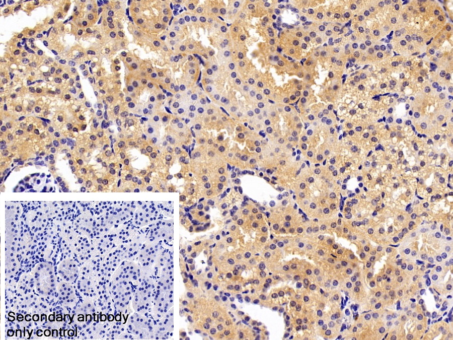 Polyclonal Antibody to Transferrin (TF)